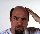 Baldness