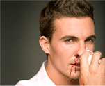 nose bleeding
